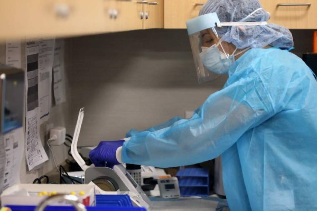 NEW YORK, NEW YORK - AUGUST 27: A medical worker shows the process for rapid coronavirus testing on the new Abbott ID Now machine at a ProHEALTH center in Brooklyn on August 27, 2020 in New York City. The portable Abbott ID Now uses a nasal swab to detect acute and infectious cases of COVID-19. ProHEALTH is offering the new service, which can deliver a test result in a s little as 15 minutes, at its centers in the tri-state area. Spencer Platt/Getty Images/AFP