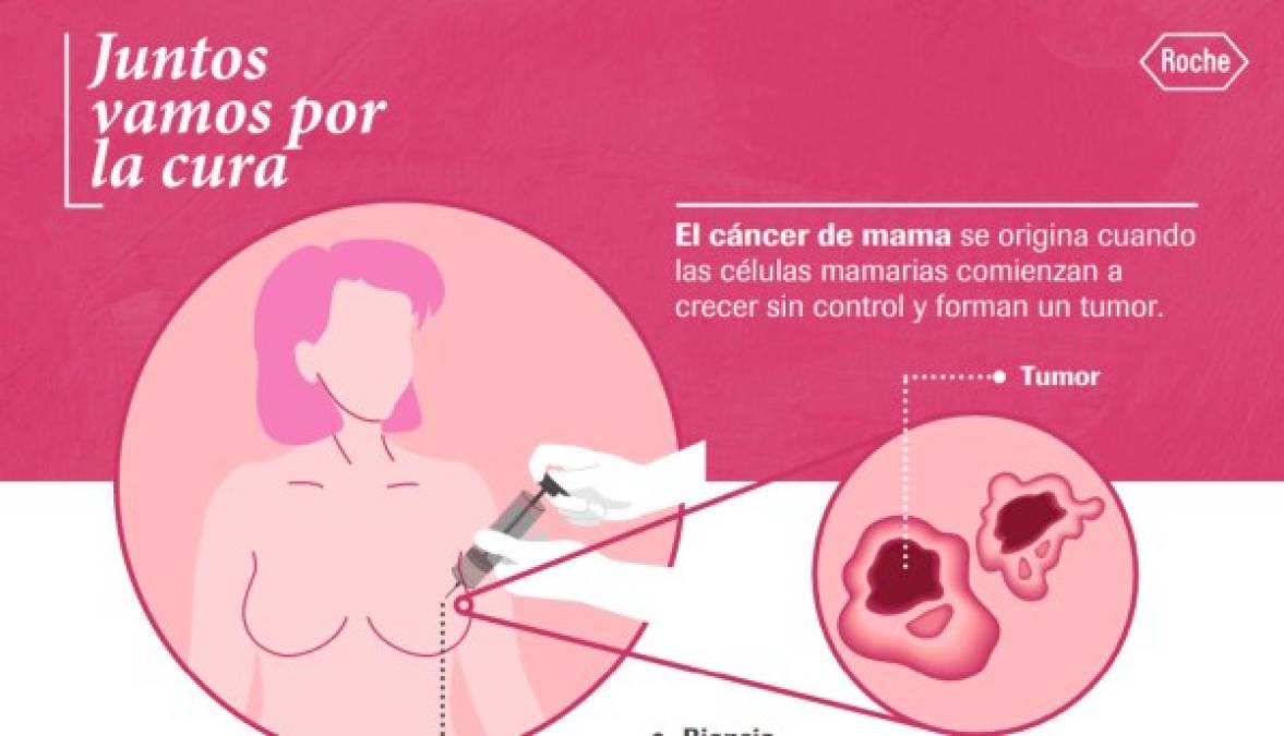 Podcast EyN: Hablemos sobre el cáncer de seno