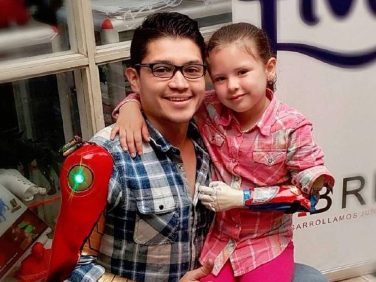 Niños superhéroes en Colombia gracias a prótesis de impresión 3D