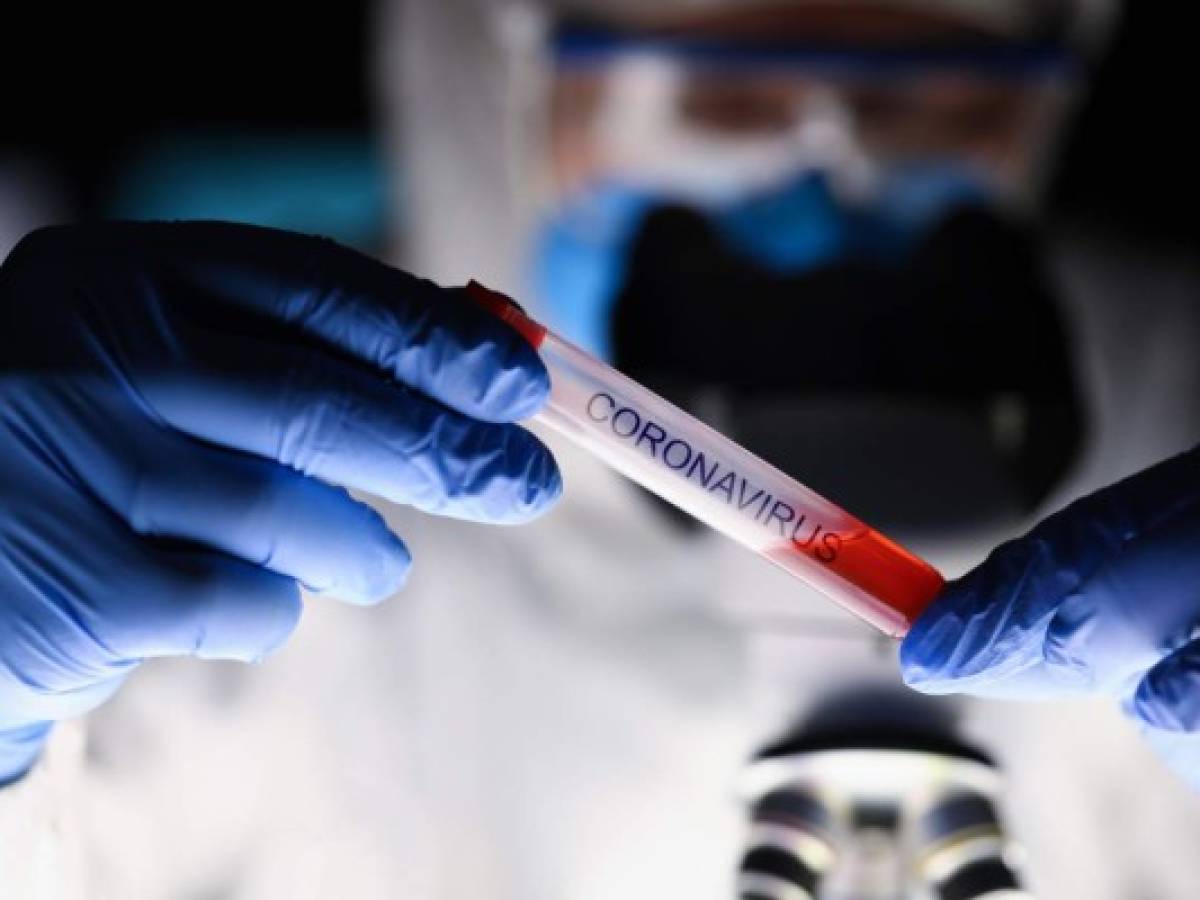 Estudio: EE.UU. pudo haber evitado más de 400,000 muertes por coronavirus