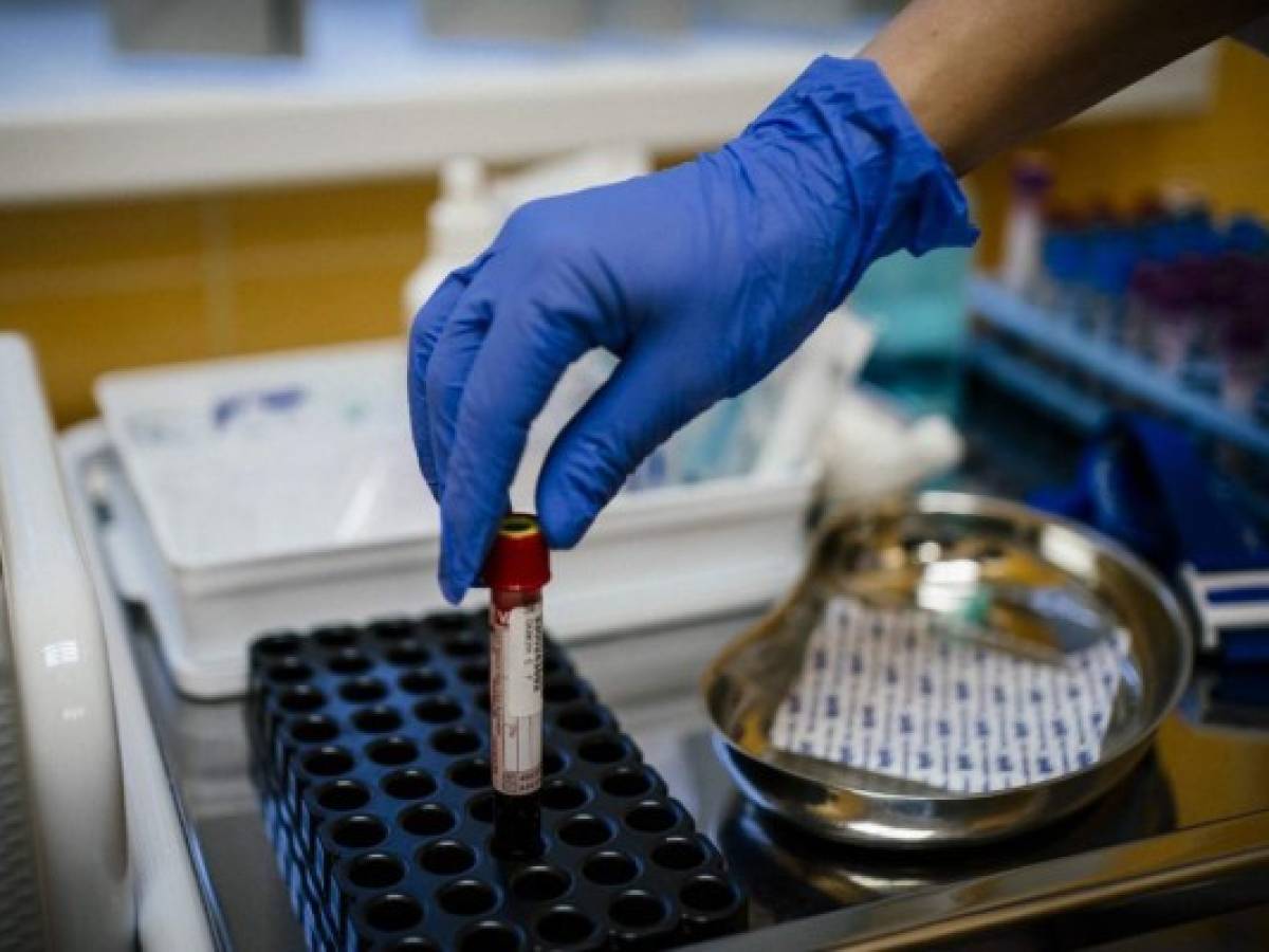 Entrepreneur Stanislav Skakun, 36, has his blood taken for analysis at a private clinic in Moscow on November 28, 2019. - Some add chips to their hands to open doors or start cars, others hope to live longer through intensive monitoring of their bodies. They are biohackers, people who seek to 'upgrade' their bodies with experimental technology and DIY health fixes. In Russia, the movement is spreading, with social media forums, conferences and businesses springing up to cater to their needs. (Photo by Dimitar DILKOFF / AFP)