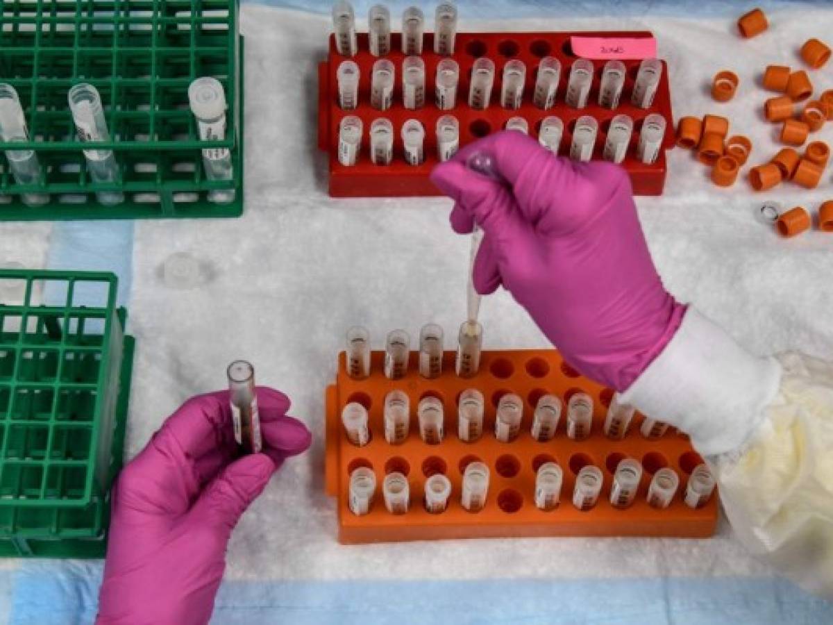 NYT: Mielitis transversa, enfermedad por la que AstraZeneca paralizó los ensayos de vacuna contra covid-19