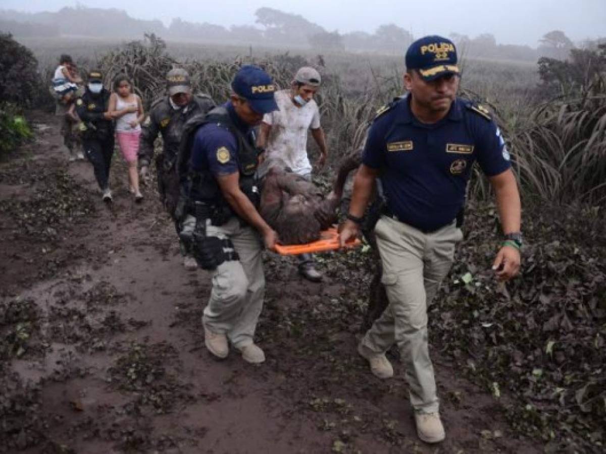 Police officers carry a wounded man after the eruption of the Fuego Volcano, in El Rodeo village, Escuintla department, 35 km south of Guatemala City on June 3, 2018. / AFP PHOTO / NOE PEREZ Police officers carry a wounded man after the eruption of the Fuego Volcano, in El Rodeo village, Escuintla department, 35 km south of Guatemala City on June 3, 2018. / AFP PHOTO / NOE PEREZ
