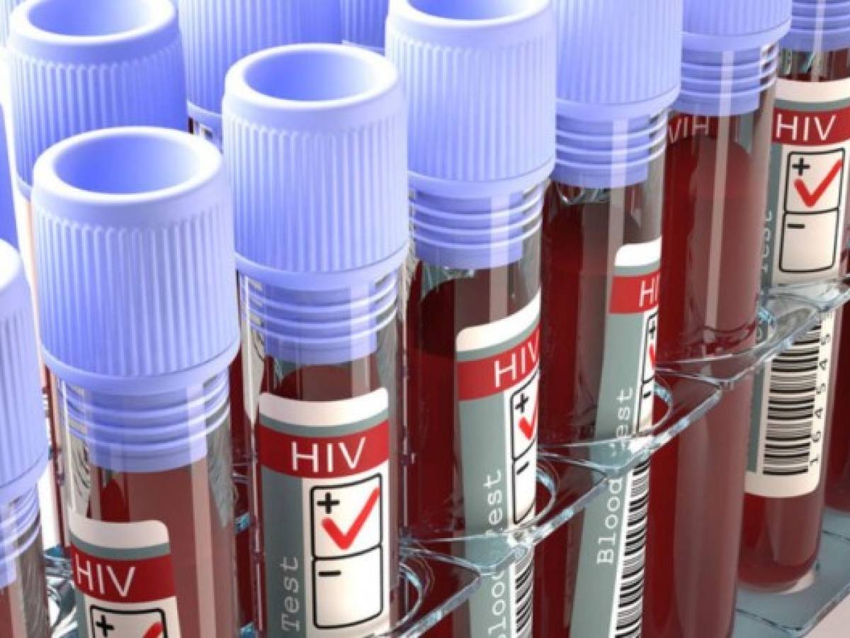 Vacuna experimental contra VIH fracasa