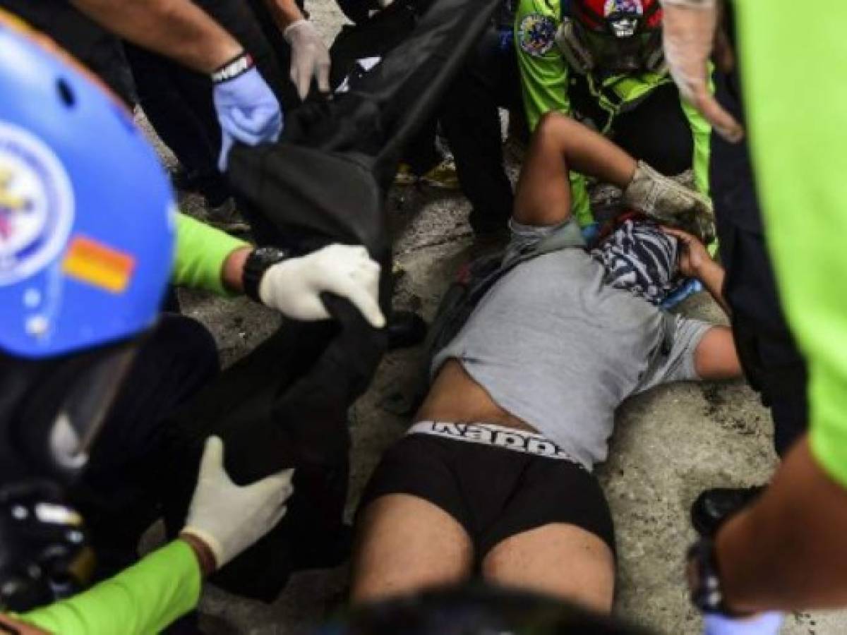 An opposition activist lies on the ground after being injured in a leg during clashes following a march towards the Supreme Court of Justice (TSJ) in an offensive against President Maduro and his call for Constituent Assembly in Caracas on July 22, 2017.The Legislative power, controlled by the opposition, appointed Friday a parallel supreme court in a public session claiming the TSJ judges had been illegally appointed by the parliaments former pro-government majority. / AFP PHOTO / RONALDO SCHEMIDT