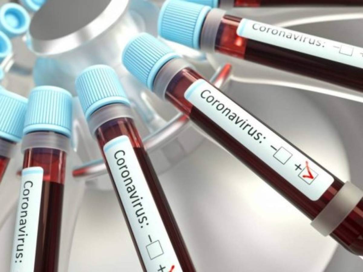 Rusia anuncia ensayo en animales de vacuna contra el coronavirus