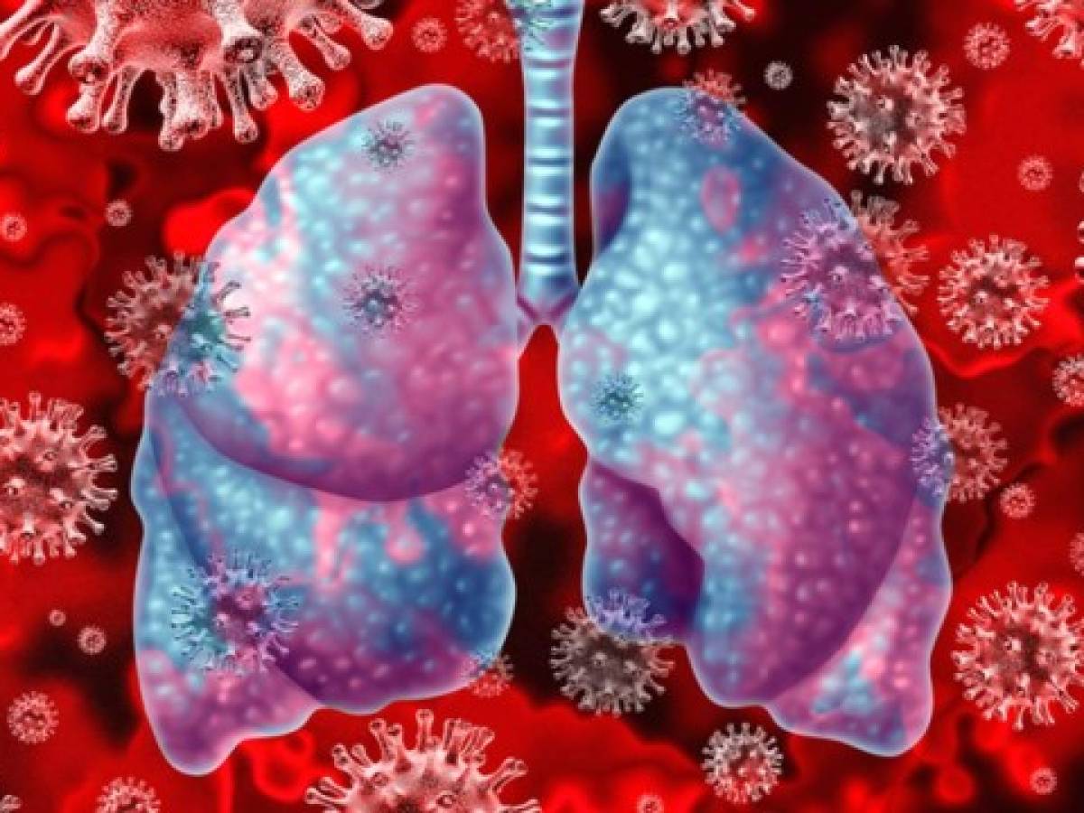 Secuelas del coronavirus: pulmones dañados