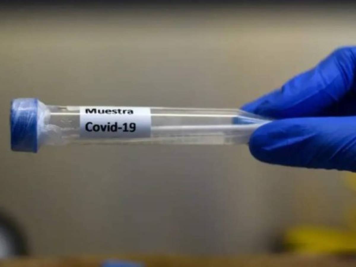 Coronavirus: Chile confirma el primer caso de la variante ómicron