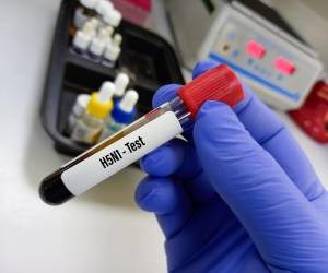 Muestra de sangre para las pruebas del virus de la influenza. Un concepto de pruebas médicas con antecedentes de laboratorio. FOTO Md Babul Hosen/ istock