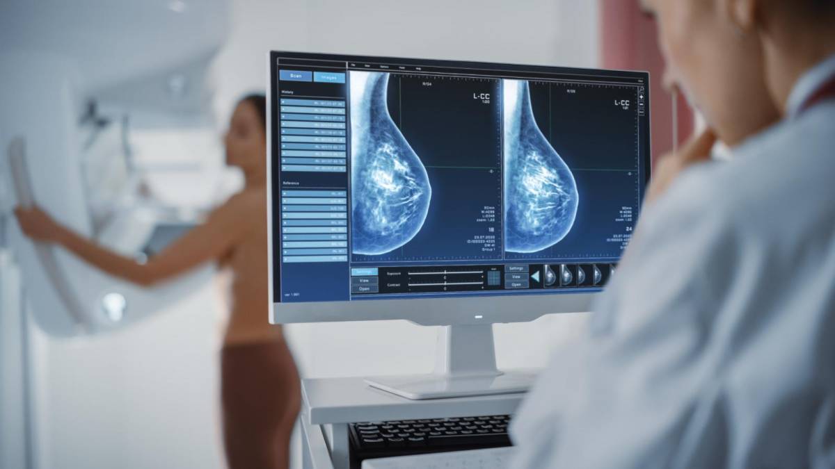 Nueva terapia para cáncer de mama cuadriplica la supervivencia