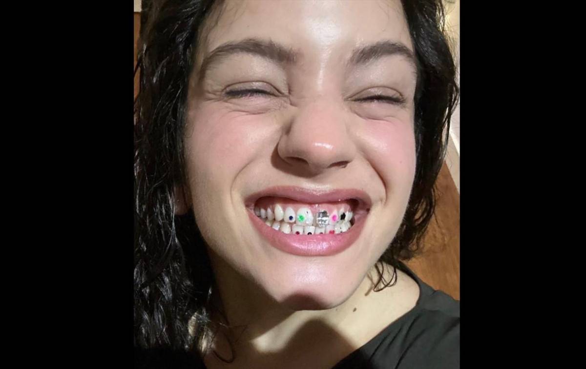 Joyas dentales, lujosa tendencia que brilla entre los famosos