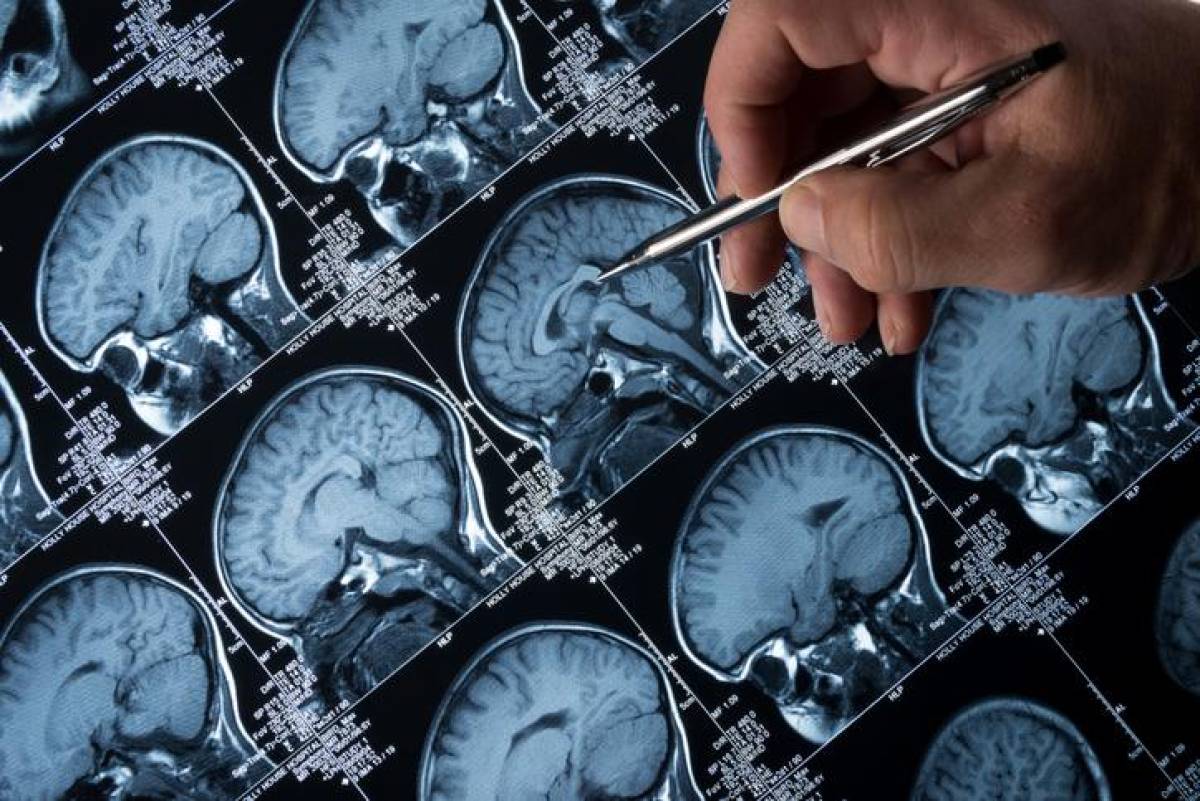 Desarrollan IA que puede pronosticar riesgo de enfermedades con décadas de antelación