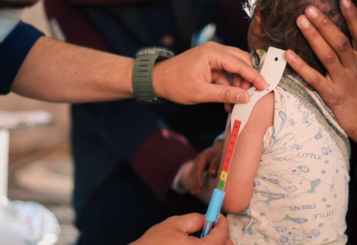 Guatemala reduce un 27 % las muertes infantiles por desnutrición aguda en 2025