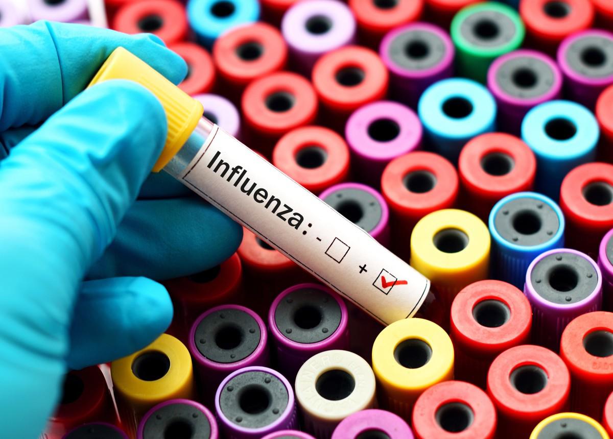 Países de Centroamérica confirman circulación de la influenza A H3N2