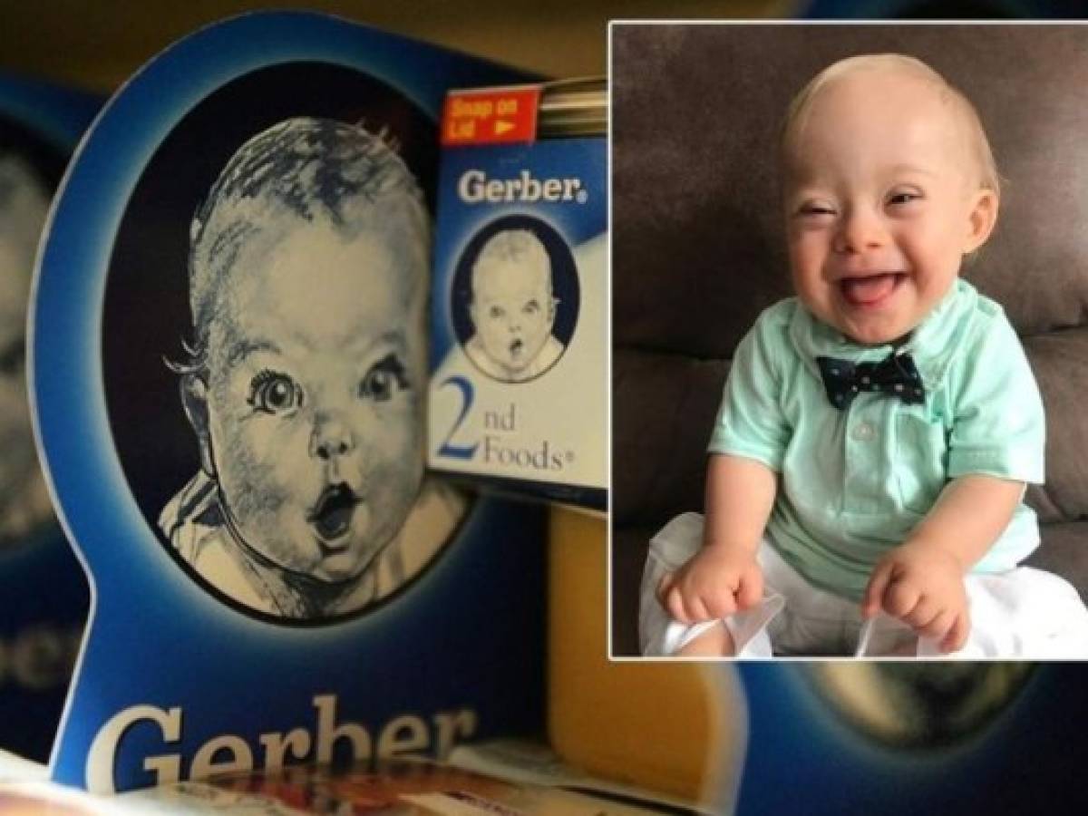 Gerber elige como imagen a un bebé con síndrome de Down