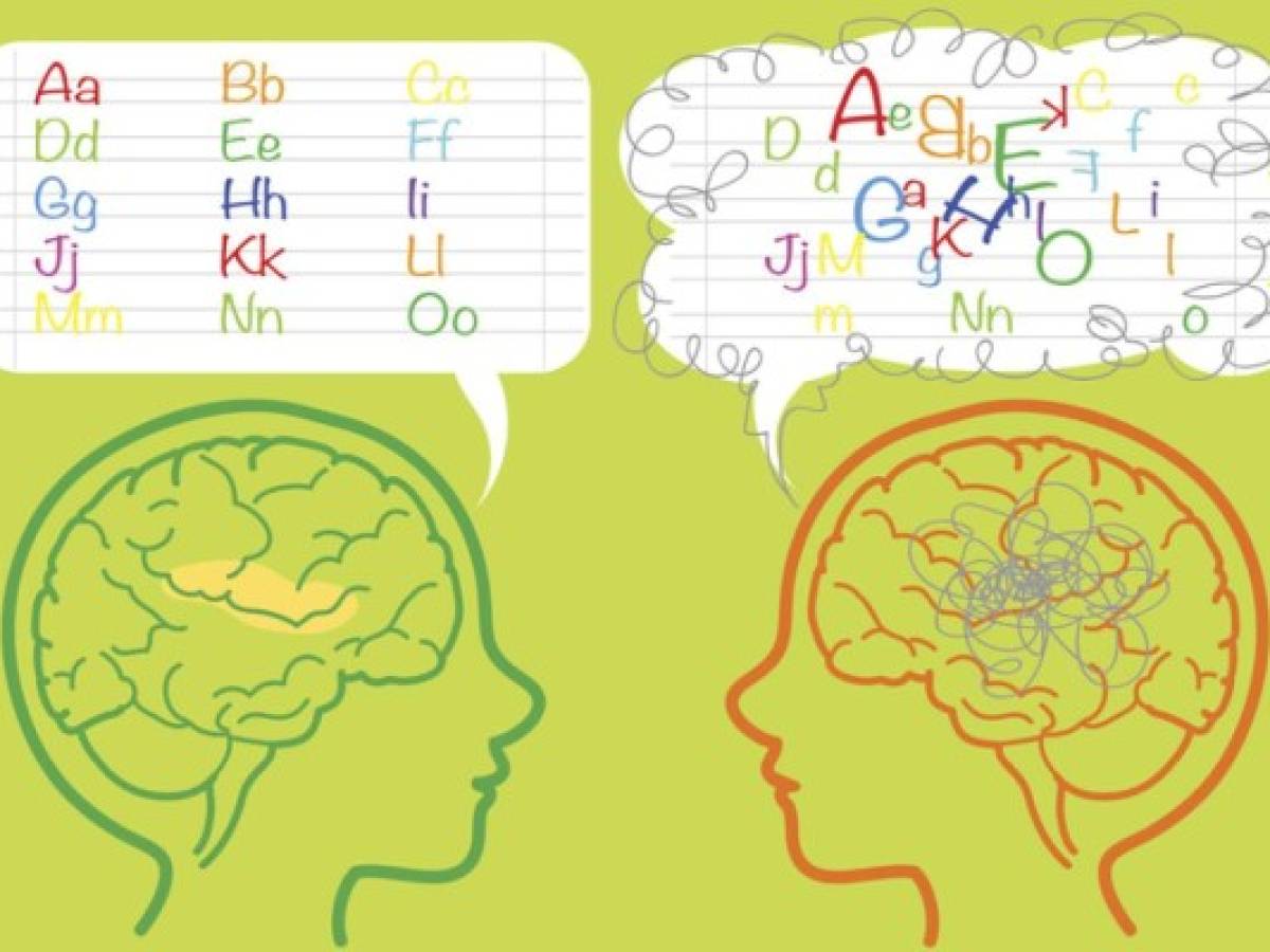 ¿Qué es la dislexia? Recomendaciones para detectar y enfrentar este trastorno