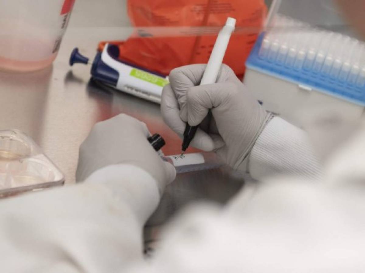Intensifican carrera mundial para encontrar vacuna contra coronavirus