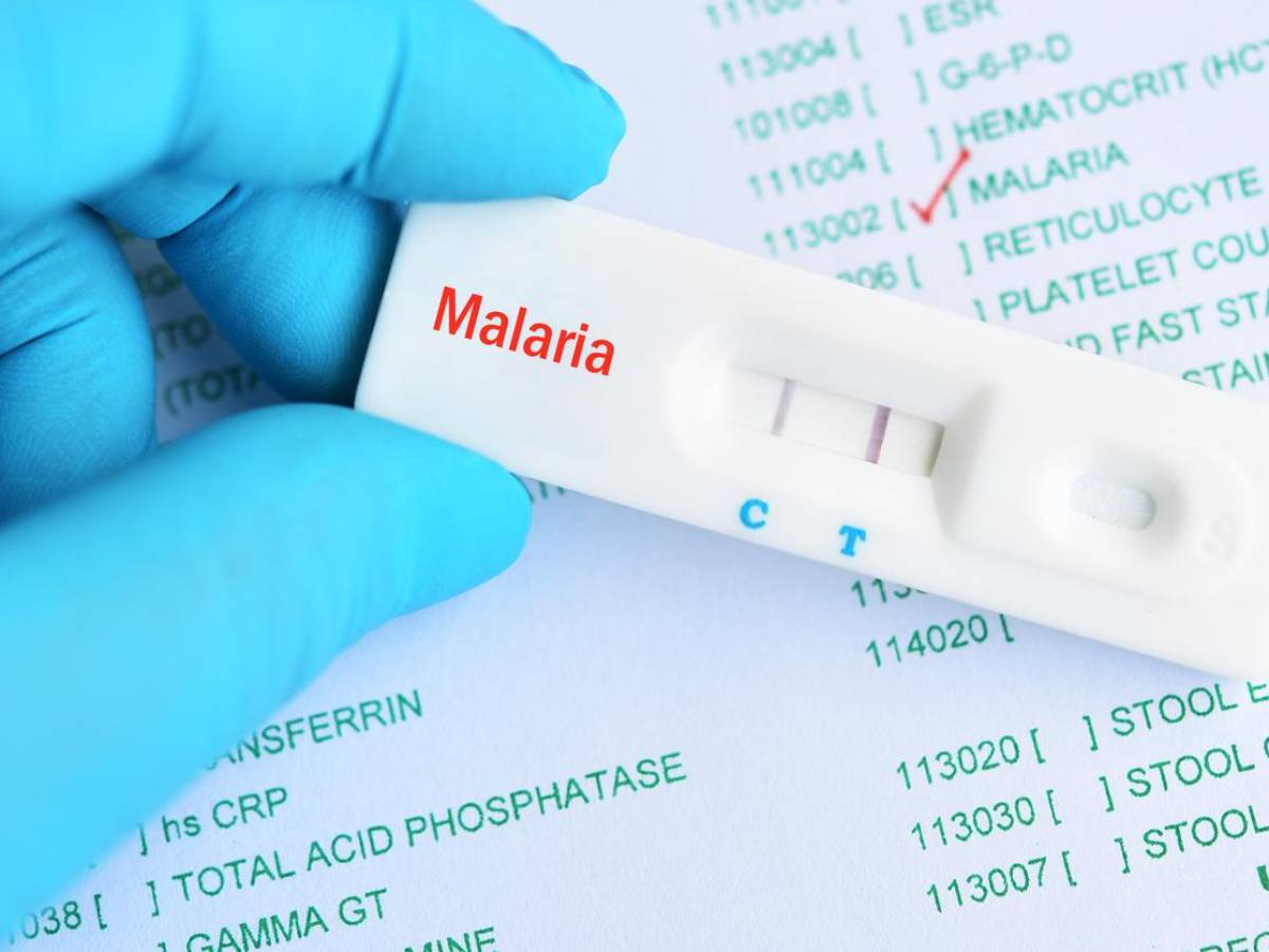 Costa Rica detecta brote de malaria en la región del Caribe
