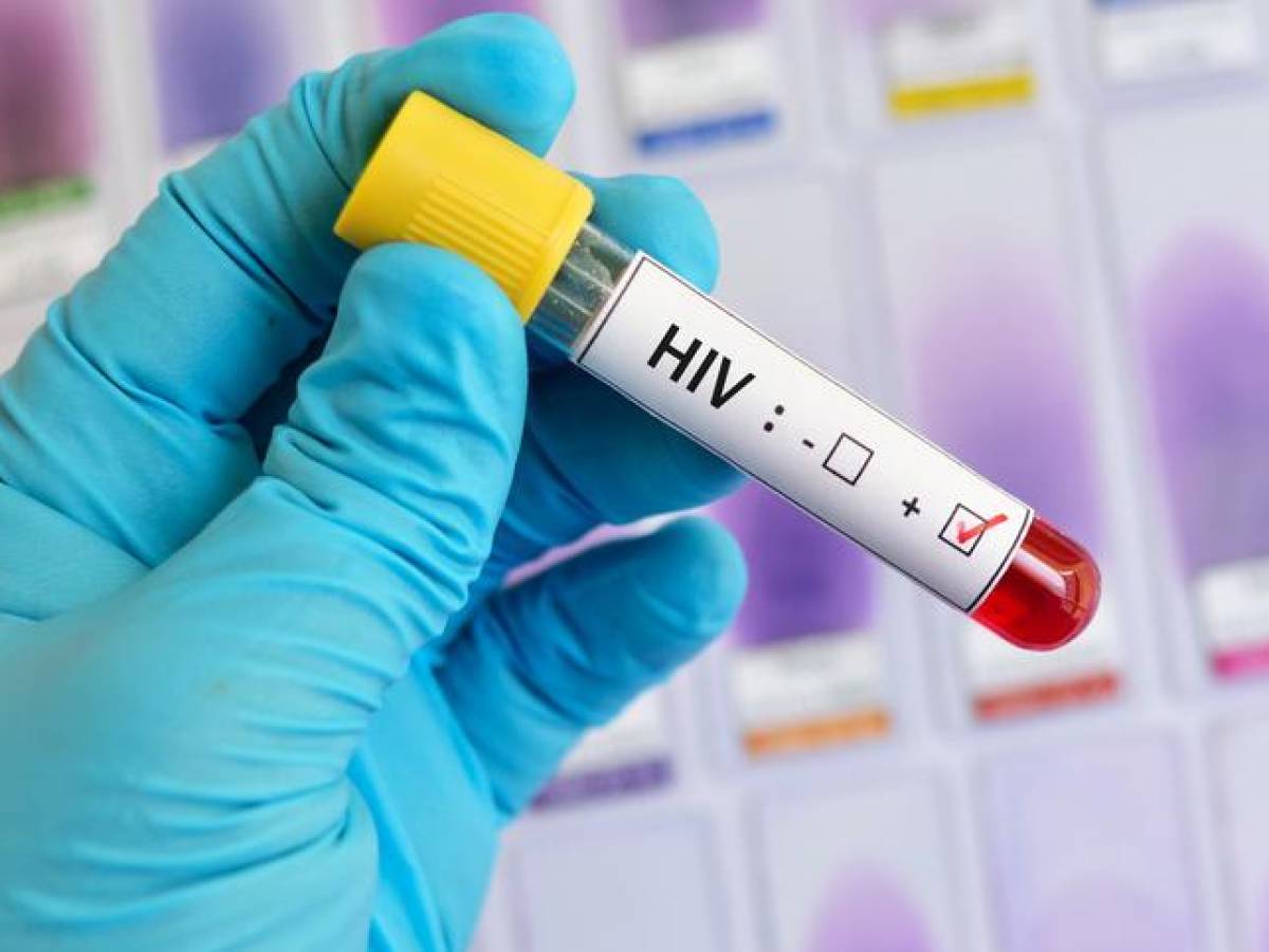 Reportan sexto caso de ‘curación’ del VIH tras un trasplante de médula ósea