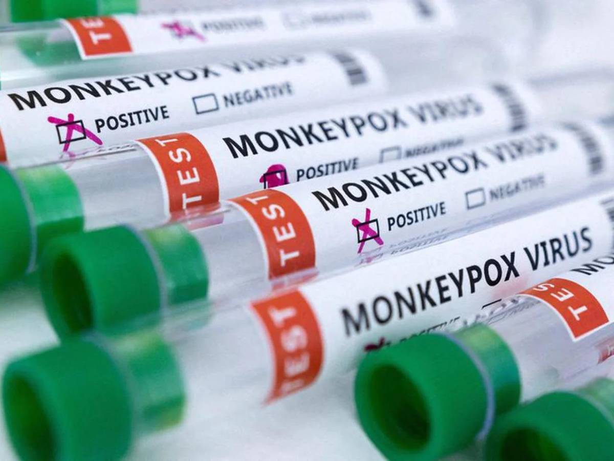 La OMS eleva a más de 9.200 los casos de viruela del mono en todo el mundo