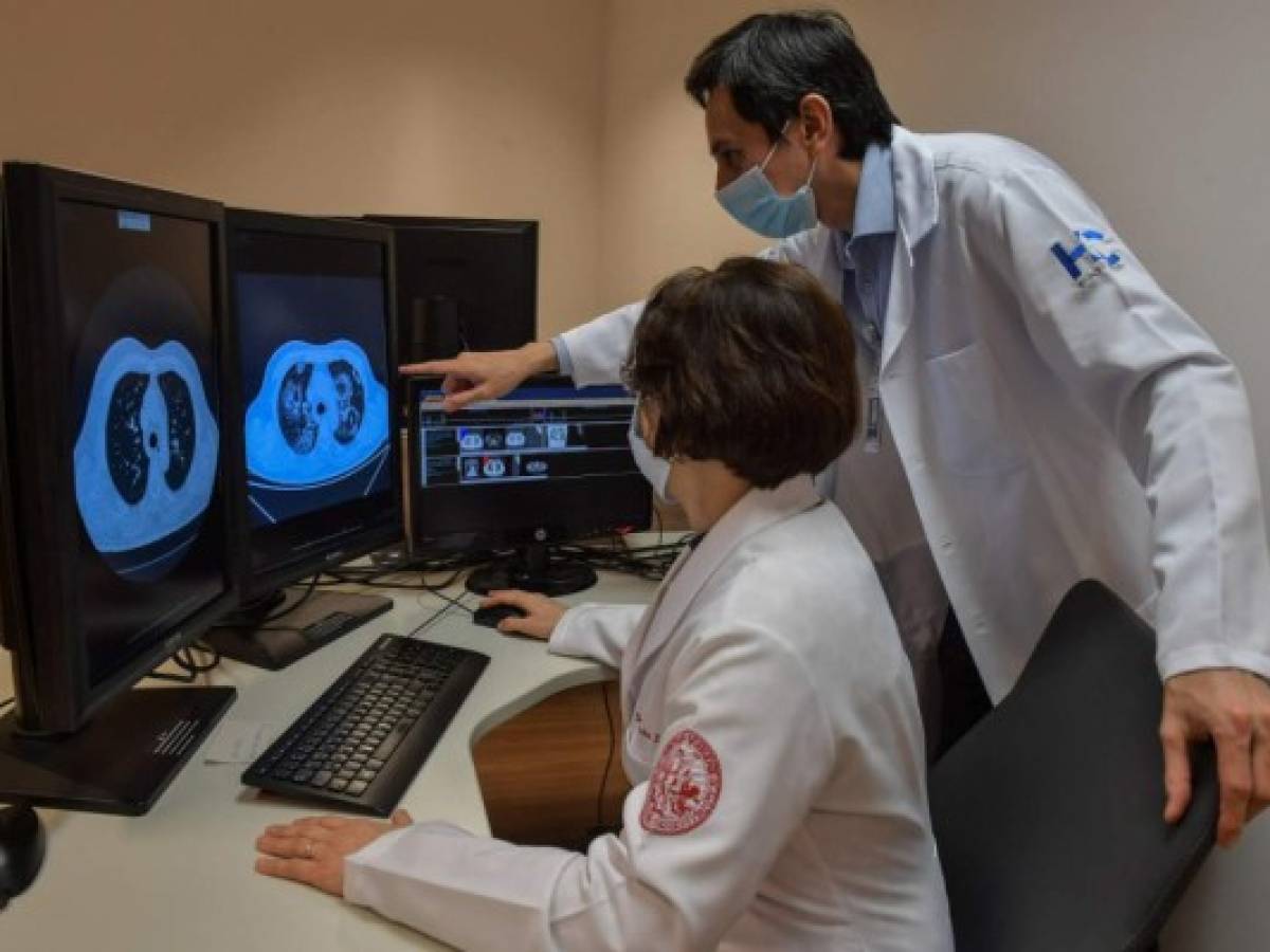 Inteligencia artificial ayuda a diagnosticar covid-19 en Brasil