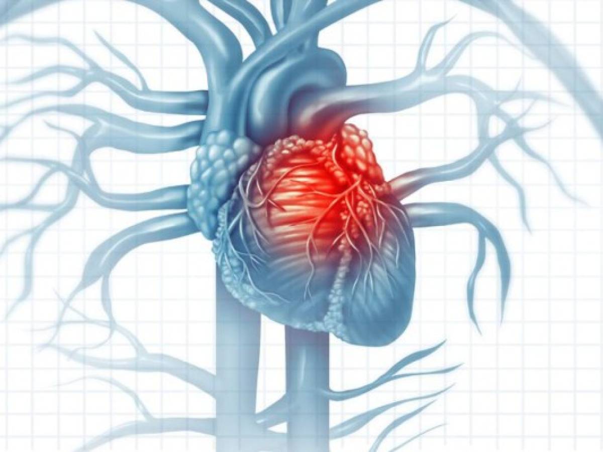 Los supervivientes de COVID-19 pueden sufrir enfermedades cardíacas a largo plazo