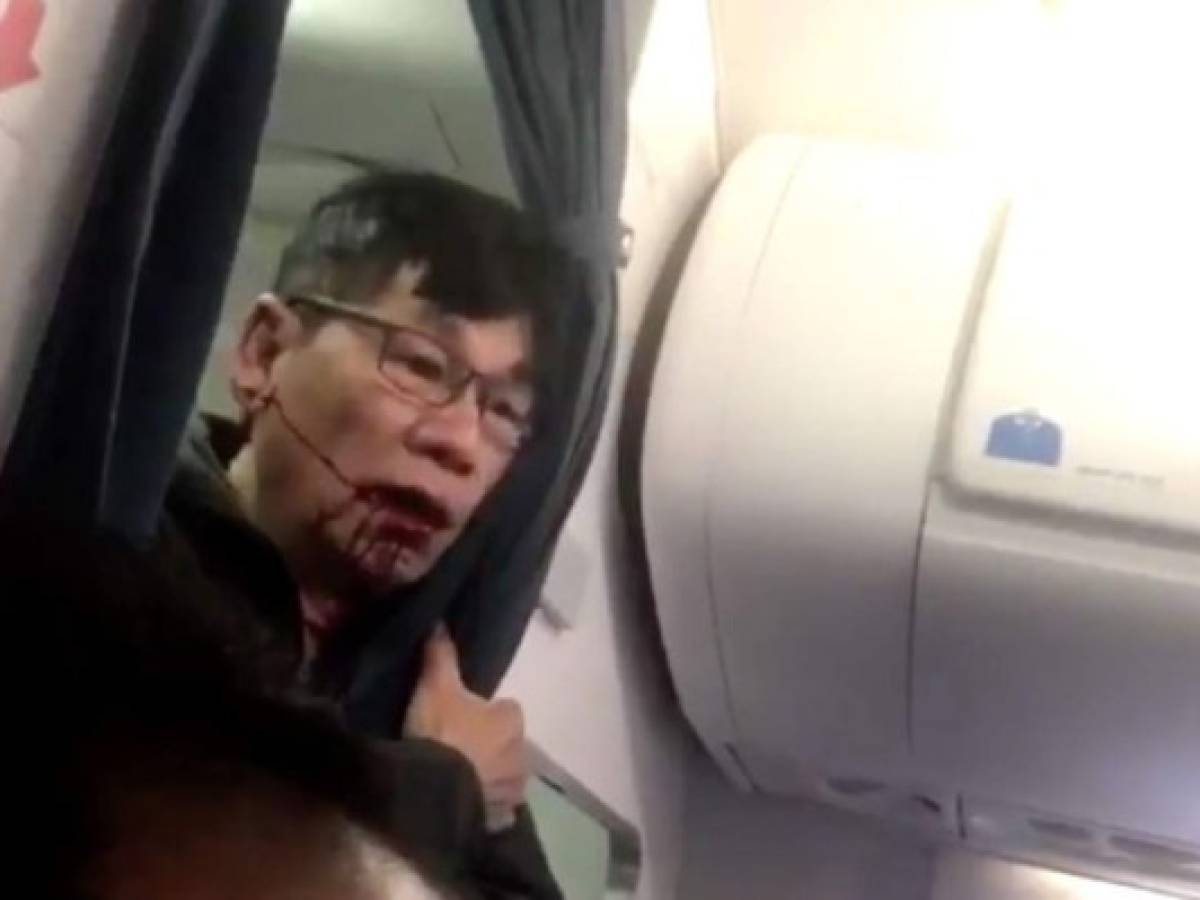 Pasajero expulsado de vuelo de United planea demandar