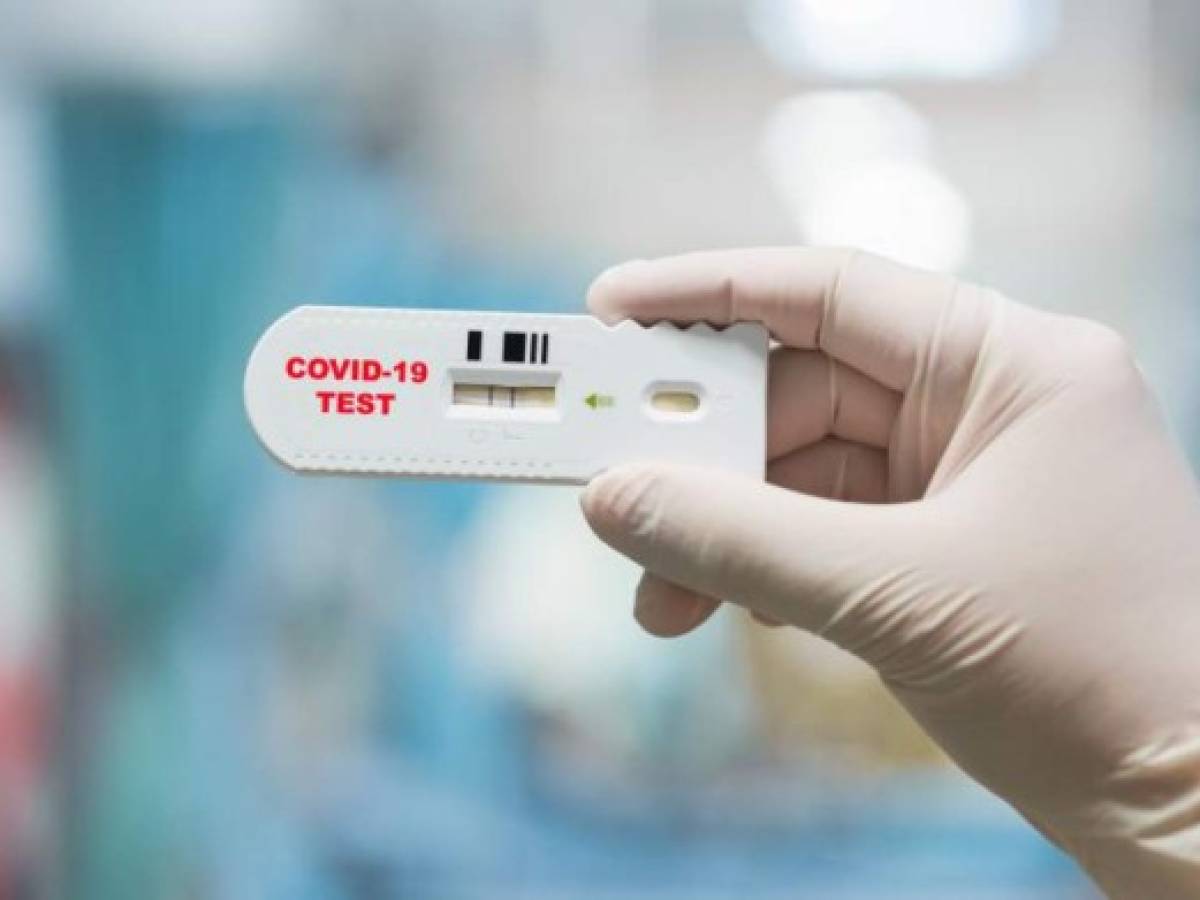 EEUU otorga US$232 millones a fabricante de test de covid doméstico y rápido