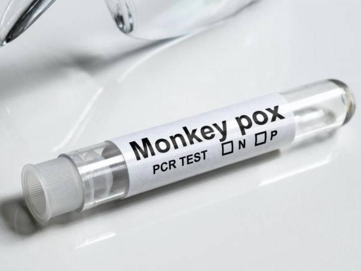 América registra casi un tercio de los casos de viruela del mono, dice OPS