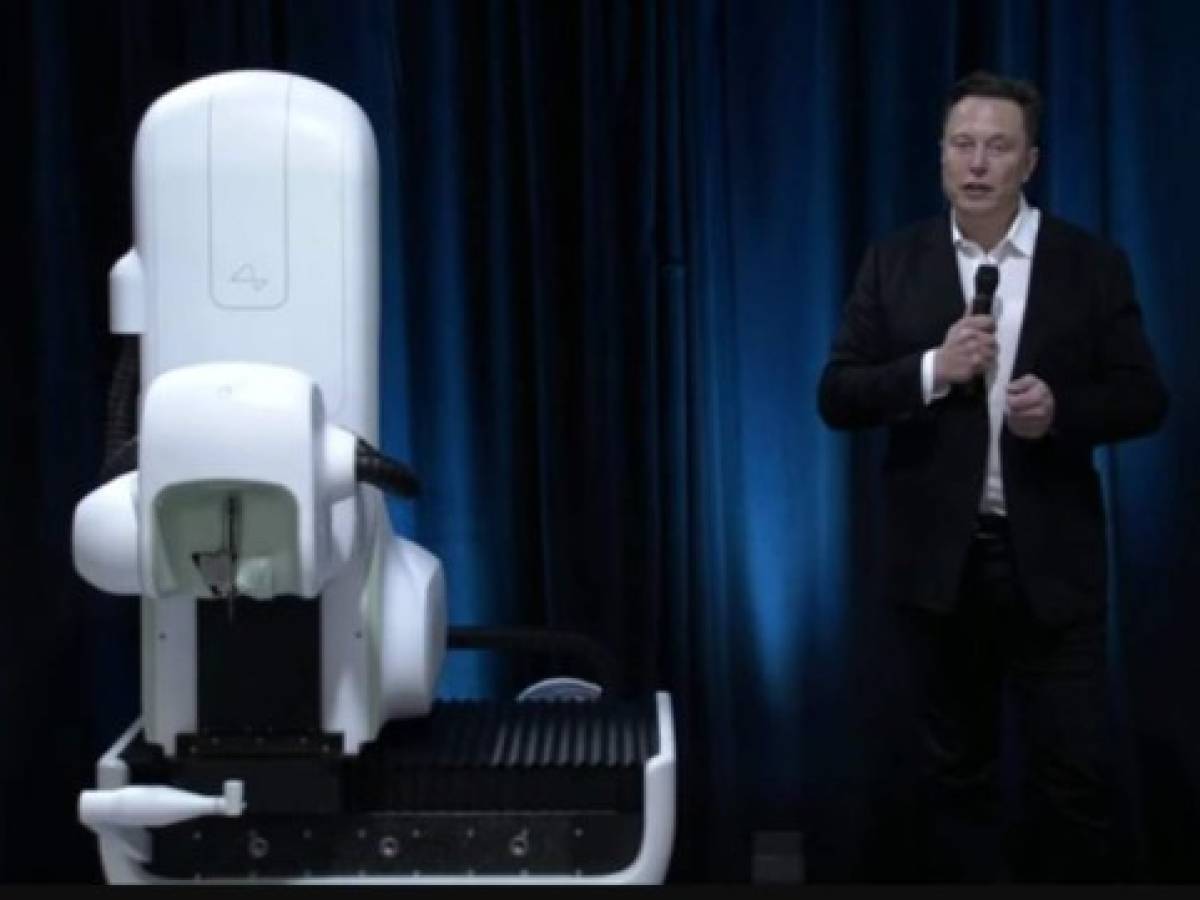 Este es el plan de Elon Musk para implantar chips en el cerebro humano