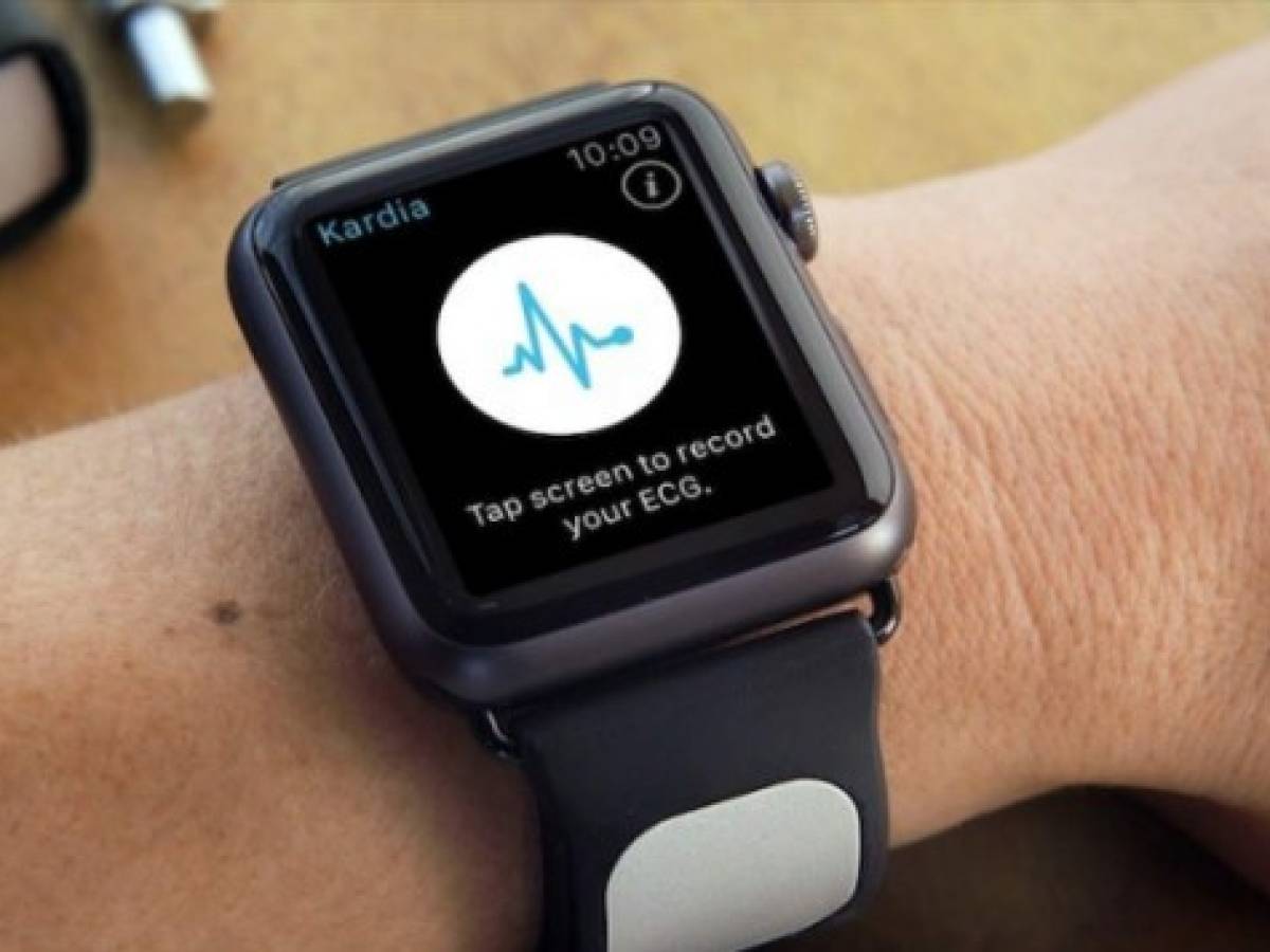 El Apple Watch podrá avisar riesgo de derrame cerebral