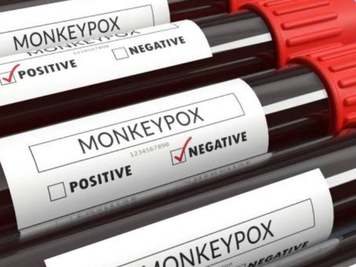 OMS investiga si rapidez de propagación de viruela del mono se debe a mutaciones