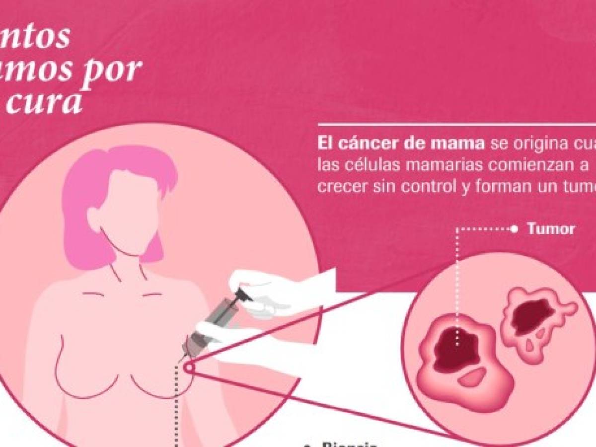 Podcast EyN: Hablemos sobre el cáncer de seno