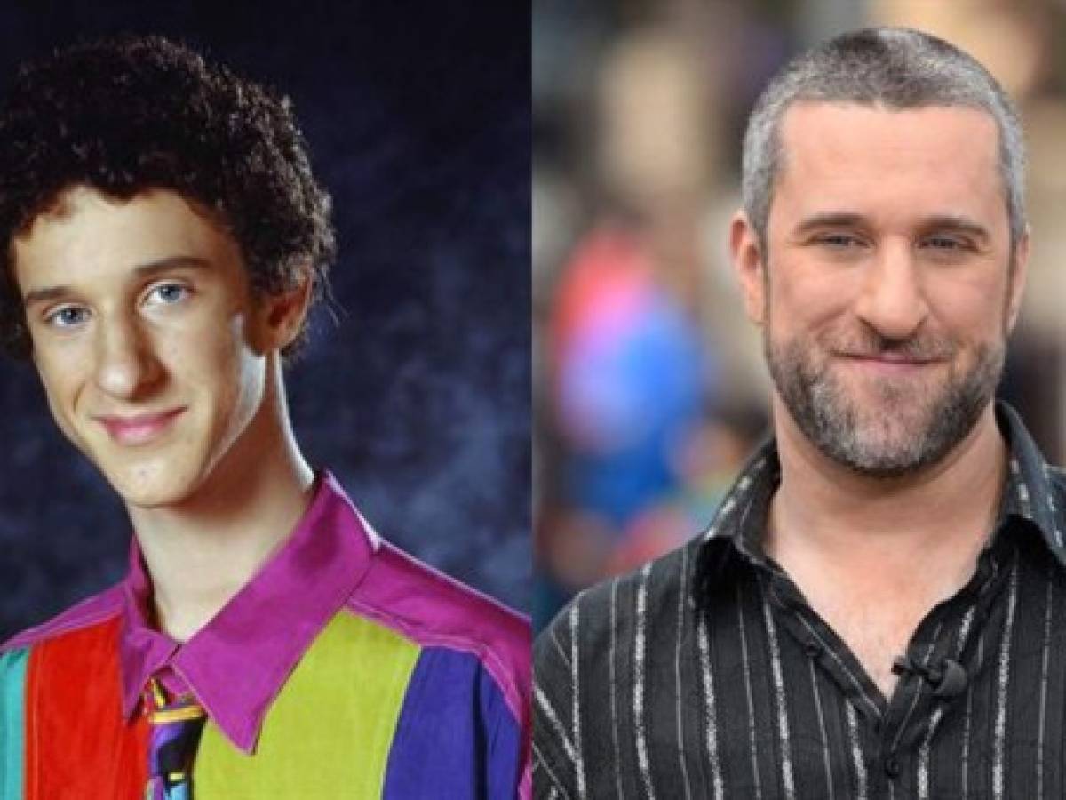 EN FOTOS: Muere el actor Dustin Diamond, Screech de 'Salvado por la campana'