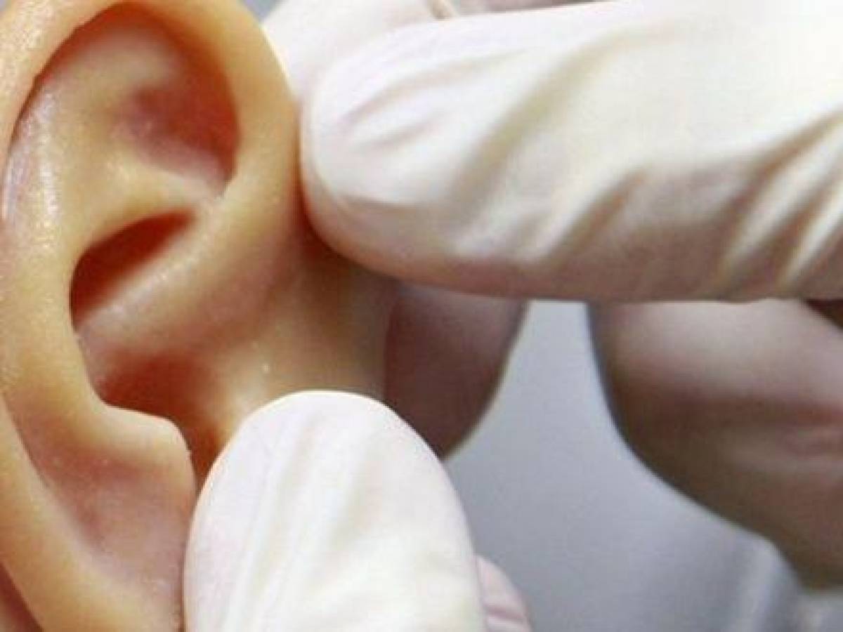 Transplantan por primera vez una oreja impresa en 3D