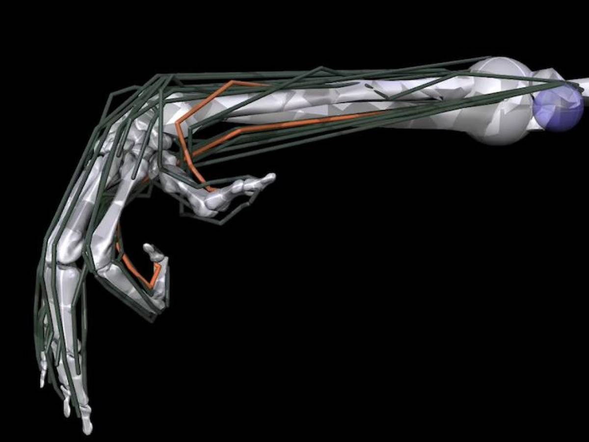 Zuckerberg quiere crear prótesis para pacientes usando Inteligencia Artificial