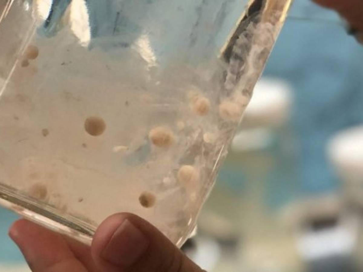 Los microplásticos en el océano son un millón de veces más de lo pensado