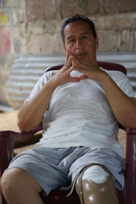 Nicaragua: Víctimas de minas enfrentan apatía y burocracia