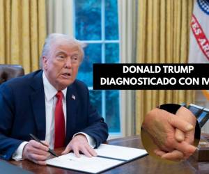<i>Leavitt reconoció que Trump sí presentaba un ligero hematoma en el dorso de la mano como muestran las fotos publicadas en la prensa, lo cual, según la portavoz, concuerda con una leve irritación de los tejidos blandos debido a los frecuentes apretones de mano y el uso de aspirina que toma como parte de un régimen preventivo cardiovascular. FOTO E&amp;N</i>