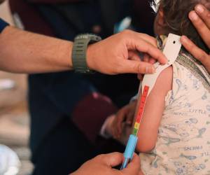 <i>El informe oficial da cuenta también de 21.091 casos de desnutrición aguda en niños menores de cinco años en todo el territorio guatemalteco. FOTO SHUTTERSTOCK</i>