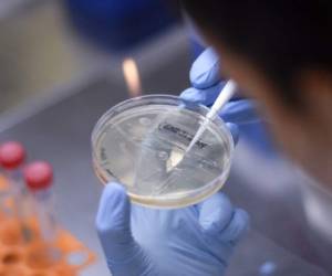 A researcher works on the development of a vaccine against the new coronavirus COVID-19, in Belo Horizonte, state of Minas Gerais, Brazil, on March 26, 2020. - The Ministry of Health convened The Technological Vaccine Center of the Federal University of Minas Gerais laboratory to conduct research on the coronavirus COVID-19 in order to diagnose, test and develop a vaccine. (Photo by DOUGLAS MAGNO / AFP)