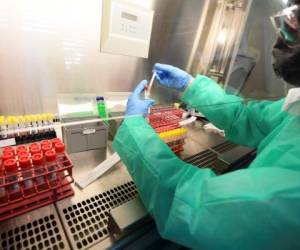 A member of medical staff handles coronavirus samples at the microbiology laboratory of the Circolo di Varese hospital, on April 3, 2020 amid the spread of the epidemic COVID-19. - Italy's three-week lockdown to stop the spread of COVID-19 has been extend through at least mid-April and its economy is expected to suffer its biggest peacetime shock since World War II. (Photo by Miguel MEDINA / AFP)