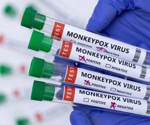 Guatemala: Ministerio de Salud confirma el primer caso de viruela del mono en el país
