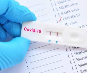 Test positivo de Covid-19 usando una prueba rápida que examina en sangre la existencia o no del virus que inició en 2019 en Wuhan, China.