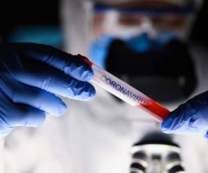 Male chemist hand in blue protective gloves hold test tube closeup background