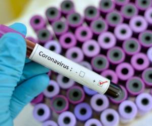 Blood sample with respiratory coronavirus positive