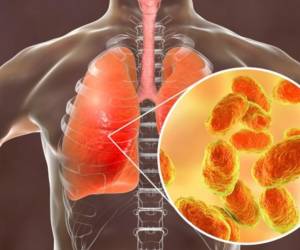 <i>El Minsa confirmó el pasado 8 de noviembre la existencia de un brote activo de tos ferina en la comarca, donde se suspendieron hasta nuevo aviso las clases y se alertó a la vecina Costa Rica dada la movilidad de los indígenas Ngäbe Buglé hacia ese país en esta época de zafra. FOTO REFERENCIA/ E&amp;N</i>