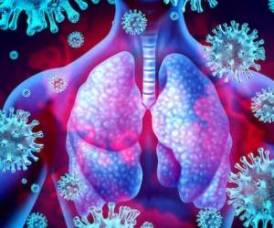 Lung virus infection and coronavirus outbreak or viral pneumonia and coronaviruses influenza as a dangerous flu strain cases as a pandemic medical health risk concept with disease cells with 3D render elements.