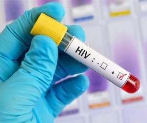 <i>Con diez pacientes ya curados, los investigadores pueden empezar a ver patrones en común y empezar a buscar otras técnicas y terapias que mimeticen este tipo de estrategias. Foto de iStock</i>