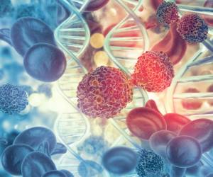 El cáncer es el responsable del 17 % de los fallecimientos en Panamá, según los datos oficiales. Foto de iStock